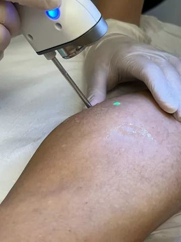 Avalanche Besenreiser