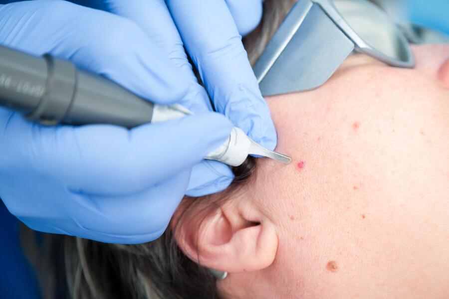 Lasertherapie